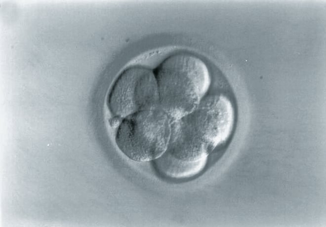 Blastozyste schaffen wie eizellen viele es zur Blastozystenkultur, sinnvoll???