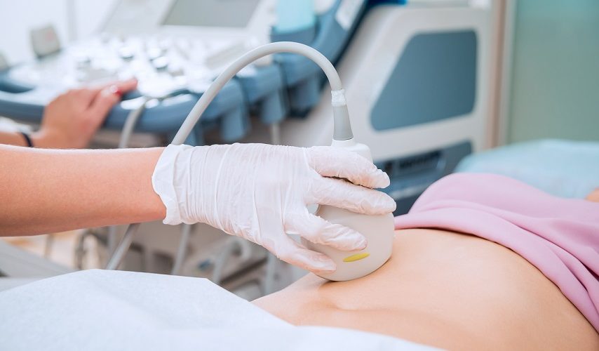4 monate nach vasektomie schwanger