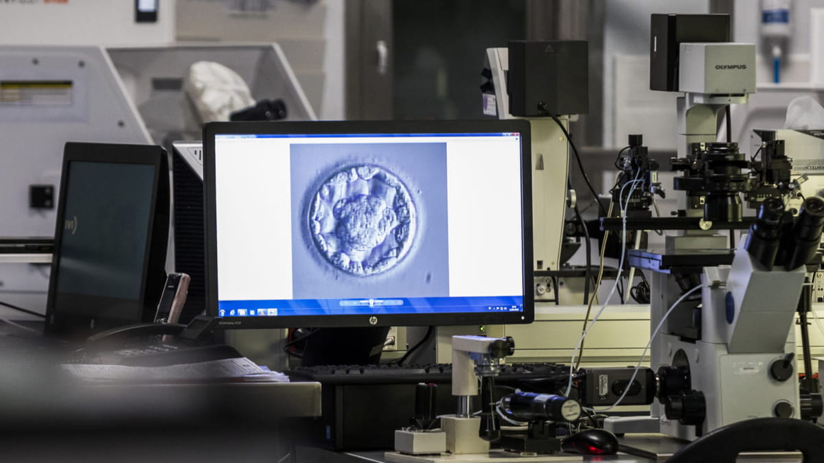 Übertragung des besten Embryos