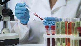 Nicht-invasive Pränatal-Tests
