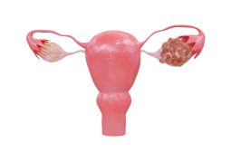 Eierstockzysten (Ovarialzysten): Ursachen, Symptome und Behandlung