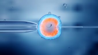 Empfehlungen nach einem Embryotransfer