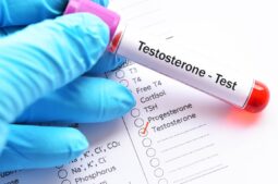 Testosteronmangel beim Mann: Einfluss auf die Fruchtbarkeit und mögliche Behandlungen